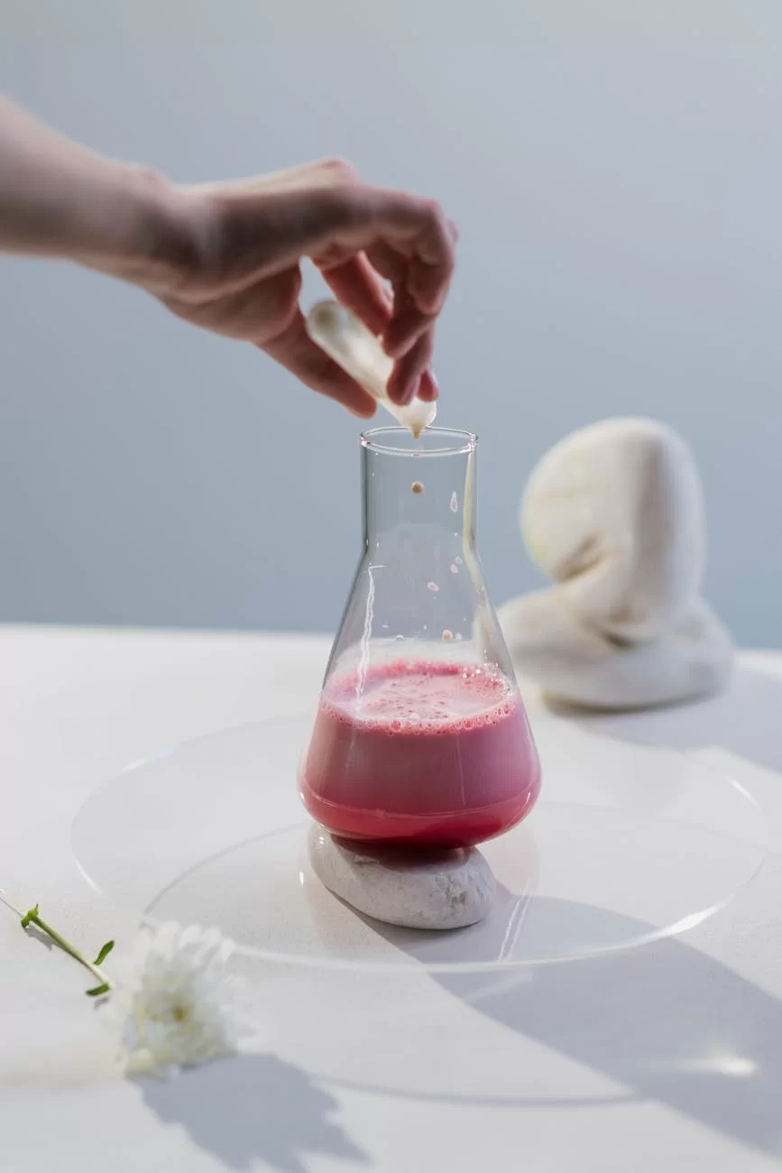 How Do Import Agencies Cope with Foreign Exchange Fluctuations?